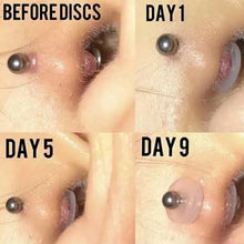 SK Studio's Medicated Silicone Healing Discs - Gentle and effective solution for piercing bumps in Pakistan